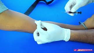 How To Do Venous Blood Sampling Venipuncture  StepbyStep Description of Procedure  Clinicals [upl. by Johny142]