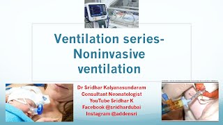 Ventilation seriesa basic introduction to noninvasive ventilation Dr Sridhar Kalyanasundaram [upl. by Leandra959]