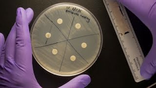 ID Laboratory Videos Antibiotic susceptibility testing [upl. by Lamoree946]