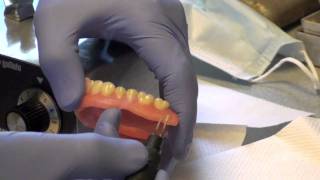 Denture Soft Reline Part 2 [upl. by Anauqahs]