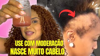 âœ¨SEM QUEDA DE CABELO CABELO CRESCE MUITO COM APENAS 2 INGREDIENTES CABELO ATÃ‰ O BUMBUM ðŸ˜± [upl. by Slavic]