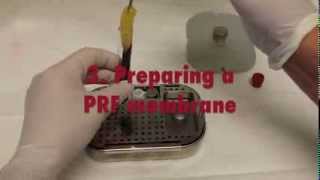 Platelet Rich Fibrin PRF  A short introductory Video [upl. by Nomannic153]