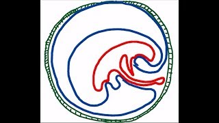 Results of folding of embryonic disc DR SAMEH GHAZY [upl. by Maximo]