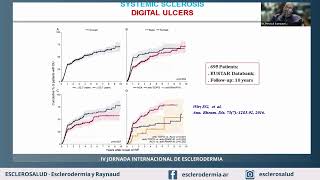 AVANCES EN EL TRATAMIENTO DE LA ESCLEROSIS SISTÉMICA [upl. by Leontine]