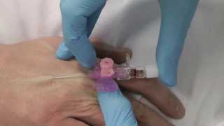 Cannulation How to gain IV access [upl. by Elisabetta]