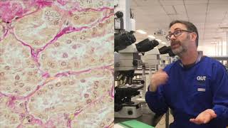 Microscope tutorial  Troubleshooting the Van Gieson stain [upl. by Eylrac287]