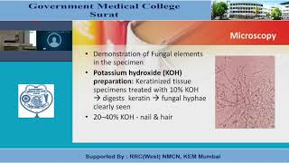 Systemic Mycosis [upl. by Svoboda]