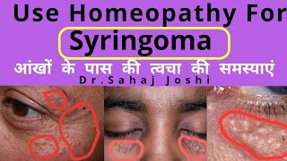 syringoma homoeopathic treatment [upl. by Stag]