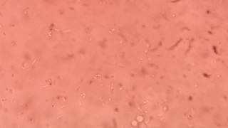 Listeria monocytogenes tumbling motility under microscope [upl. by Dafodil]