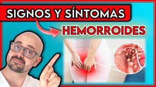 ¿Hemorroides o Cáncer de Colon  SIGNOS y SÍNTOMAS que indican HEMORROIDES [upl. by Burkhart]