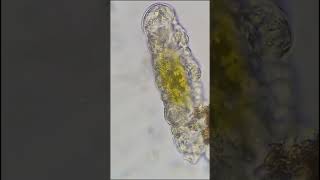 Tardigrade under the microscope  400x shorts [upl. by Halilahk414]