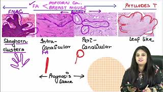 Pathology RR Part 1  DrPreeti Sharma  FMGE amp NEETPG [upl. by Ericha]