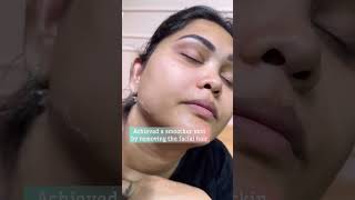 Removing facial hairs  Ashmi [upl. by Revned]