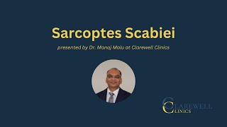 Understanding Sarcoptes Scabies Expert Insights with Dr Manoj Malu from Clarewell Clinics [upl. by Adnaval]