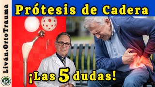 Artrosis de cadera  Las 5 dudas más frecuentes sobre la prótesis total [upl. by Aggy267]