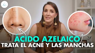 🔴 MILAGROSO ACIDO AZELAICO ¡NO MÁS MANCHAS ROSACEA y ACNÉ drapilarochoa  Dermatologa [upl. by Bartley399]