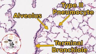 Pneumocytes  Type 1 Type 2 and Clara Cells [upl. by Auqenaj978]