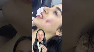 tendencias de belleza ¿La conocías skincare piel belleza cuidadodelapiel saludmental [upl. by Avle]