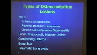 Diagnosis and Treatment of Cavitational Osteonecrosis [upl. by Ehsom]