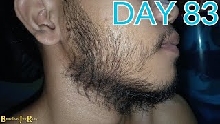 DAY 83  KIRKLAND MINOXIDIL BEARD JOURNEY [upl. by Job]