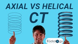 CT Scan Modes Compared Axial vs Helical [upl. by Riella]