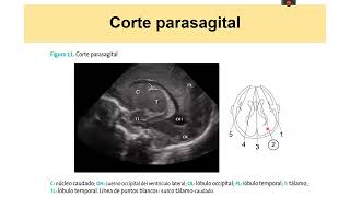 ECOGRAFIA EN PEDIATRIA  DR ABELLA  RESIDENCIA SL [upl. by Boyden]