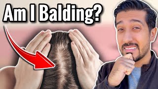 Is it Hair Loss or Hair Shedding  Shedding Hair vs Hair Loss DIFFERENCE [upl. by Nongim455]