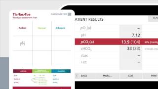 Reading the blood gas report using TicTacToe – Radiometer [upl. by Lux527]