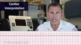 Asystole ECG Rhythm Interpretation [upl. by Niwdog118]