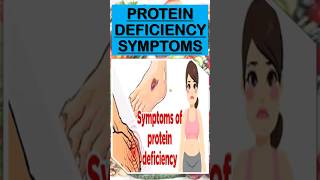 Protein deficientYes or no See for yourselfproteindeficitdeficiencyflutelovemusic [upl. by Auoh540]