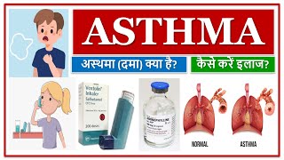 ASTHMA  MEDICINES  अस्थमा दमा क्या है कैसे करें इलाज MEDICINE USE TO TREAT ASTHMA [upl. by Ellerd741]