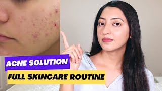 Complete Skincare Routine for Acne [upl. by Yesnek]