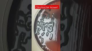 Citrobacter koseri Colony morphology on CLED agar [upl. by Uela]