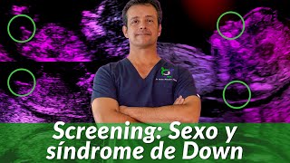 Ultrasonido 12 semanas Sexo y síndrome de Down Screening Primer Trimestre de embarazo [upl. by Araet429]