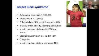 ESE Talks Rare Diseases Genetic diabetes focus on Wolfram syndrome Intro and speaker 1 [upl. by Rudolfo916]