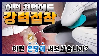 어떤 치면에도 강력접착 이런 본딩제 써보셨습니까 [upl. by Annawt]