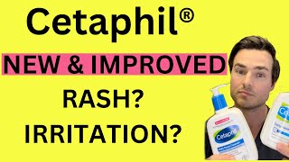 Cetaphil Rash Ingredients Triggering Skin Nightmares [upl. by Xet]