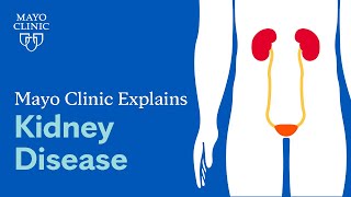 Mayo Clinic Explains Kidney Disease [upl. by Arikal261]