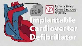 Cardioversion  Defibrillation Technique [upl. by Epoh]