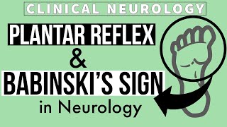 PLANTAR REFLEX  BABINSKIs SIGN  Equivocal Plantar  Other methods  Clinical Neurology [upl. by Erickson]