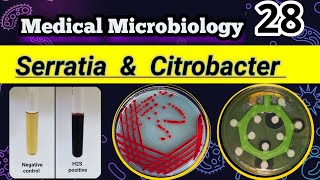 Serratia amp Citrobacter Late lactose Coliforms شرح بالعربي [upl. by Nalad468]