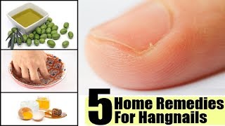 5 Effective Home Remedies to Get Rid of Hangnails  By Top 5 [upl. by Lednyc]