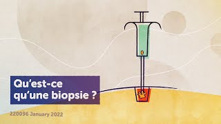 PARTIE 3  VIDÉO 1  Questce quune biopsie [upl. by Kopaz386]