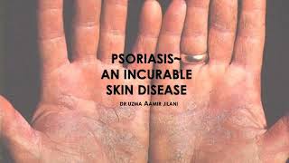 PSORIASIS A SHORT OVERVIEW  DERMATOLOGY  CLINICAL MEDICINE  MEDICAL REVISION GUIDE [upl. by Ashleigh]