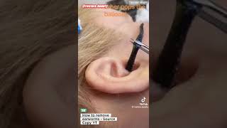 WORMS IN THE EARS YOU WON’T BELIEVE THIS 🙀 How To Remove EARWORMS from the Ears [upl. by Naniac]