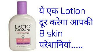 8 Amazing Benefits of LACTO CALAMINE for oily skin  hindi [upl. by Gawlas315]