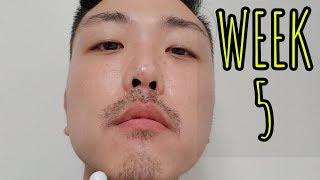 WEEK 5 MINOXIDIL BEARD GROWTH [upl. by Nihs]