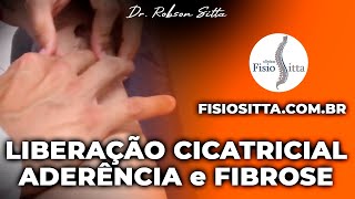 MASSAGEM de LIBERAÇÃO CICATRICIAL PREVENÇÃO ADERÊNCIA FIBROSE Clínica Fisioterapia Dr Robson Sitta [upl. by Free]