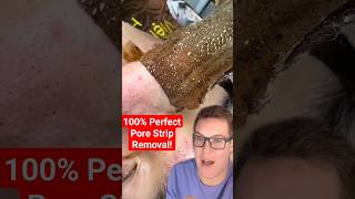 😍 Perfect PORE STRIP REMOVAL shorts [upl. by Eitten740]