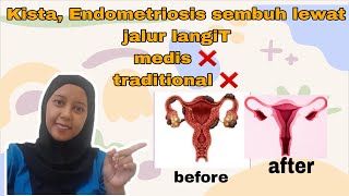 Menjadikan diri sabar menyembuhkan kista endometriosis Di luar nalar [upl. by Naid]